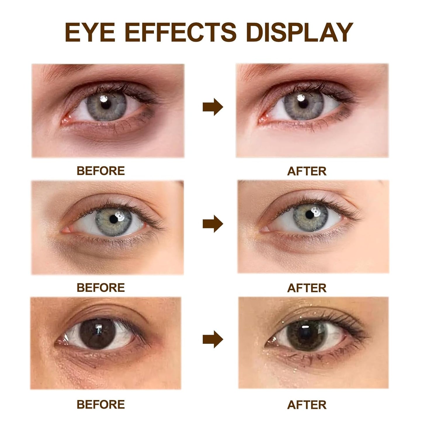 Dr. Melaxin Eyephalt Eyebag Cream-Best Eye Cream for Dark Circles & Puffy Eyes