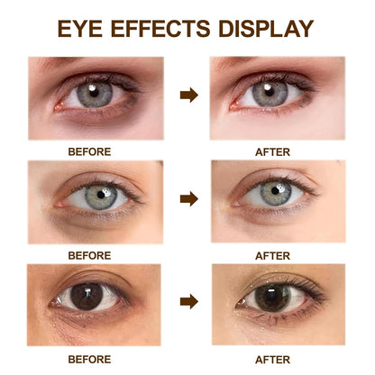 Dr. Melaxin Eyephalt Eyebag Cream-Best Eye Cream for Dark Circles & Puffy Eyes