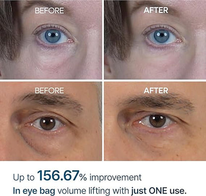 Dr. Melaxin Eyephalt Eyebag Cream