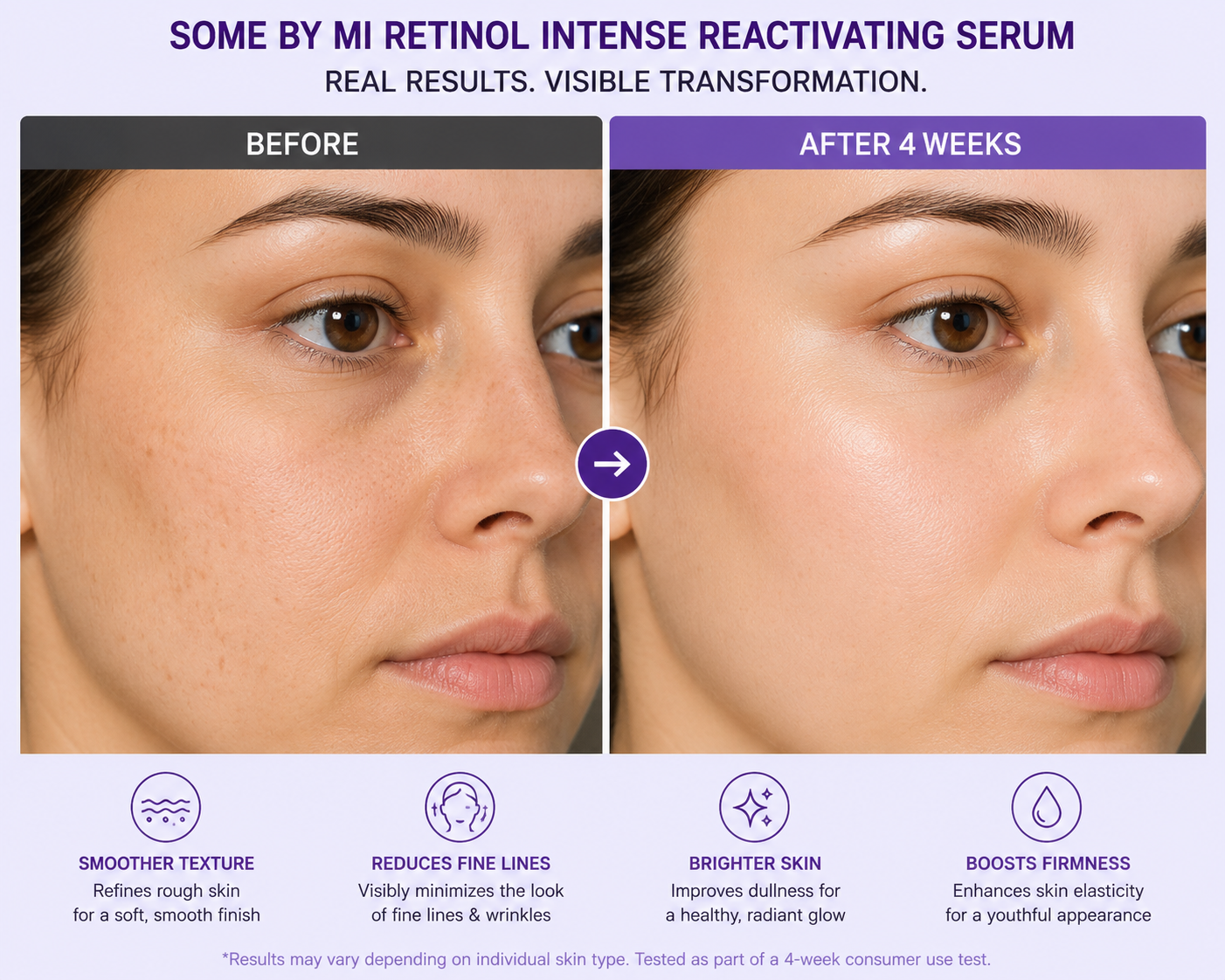 Some By Mi-Intense Reactivating Anti Aging Serum & Triple Action Eye Cream (Bundle Offer)