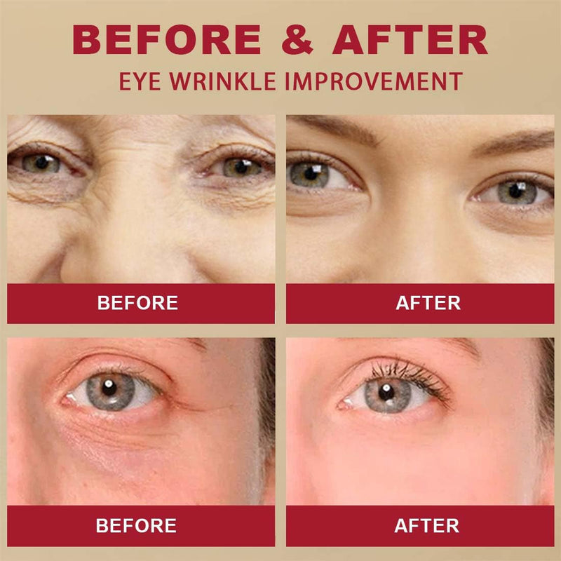 Seoul 1988 Bright Eyes Hydrating Korean Cream   Dark Circle Repair Wrinkle Smoothing
